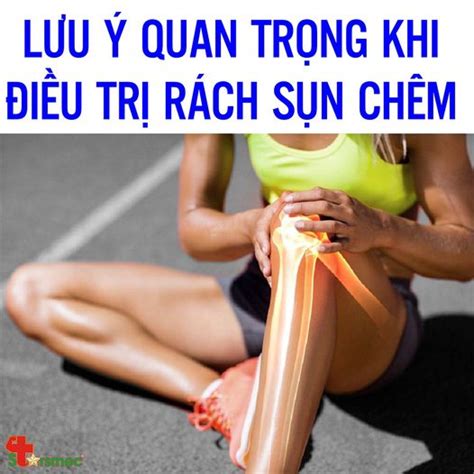 Một Số LƯu Ý Quan Trọng Khi điều Trị RÁch SỤn ChÊm