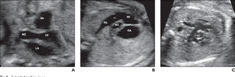 Fetal Anomalies Ultrasound