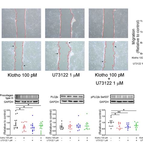 SOCE In Human Atrial Fibroblasts In 4 Different Groups Control Klotho