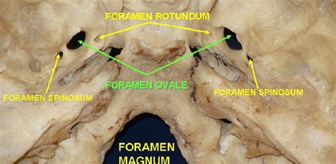 Foramen Cecum Skull