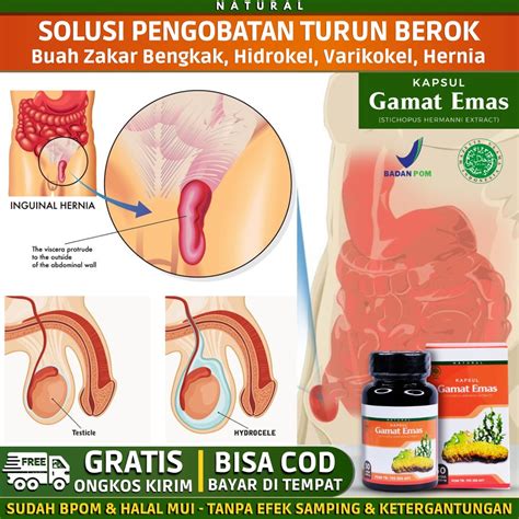 Jual Obat Hernia Turun Berok Dewasa Turun Peranakan Hidrokel Buah Zakar