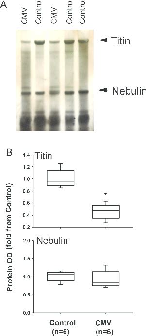 Protein expressions of titin and nebulin. (A) Representative protein ...