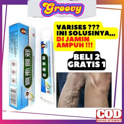 Jual OBAT VARISES OBAT VARISES DI KAKI DAN DI BETIS PALING AMPUH