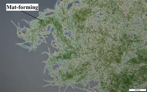 Anabaena - Cyanobacteria Guide