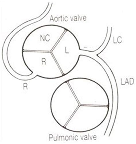 Frontiers Coronary Arteries Normal Anatomy With Historical Notes And