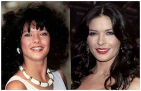 Blepharoplasty catherine Zeta Jones before and after photos ~ Celebrity ...