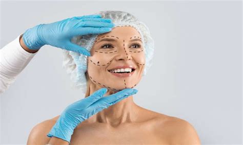 Lifting Facial Deep Plane Especialista Aponta Vantagens E Cuidados Do