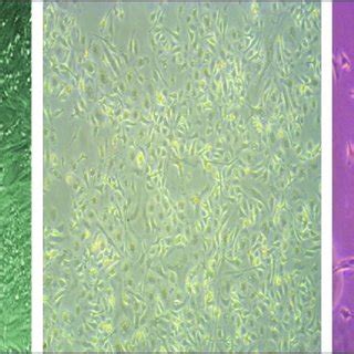 Representative Photomicrographs X Magnification Of Fibroblasts