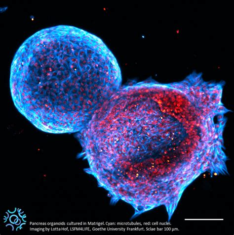 Production And Characterization Of Endocrine Cells Derived From Human