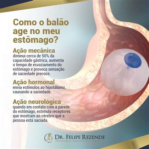 Dr Felipe Rezende O Que Bal O Intrag Strico