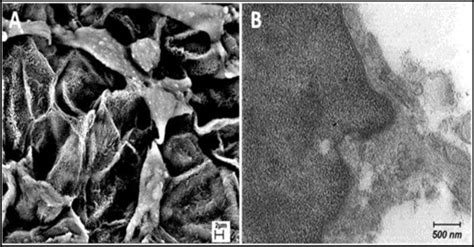 The appearance of cell pseudopod formation with scanning (A) and ...