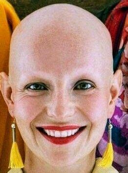 Pin On Bald Women