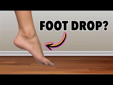 Top 3 Exercises For Foot Drop – Yoga Videos