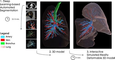 Artificial Intelligenceassisted Augmented Reality Robotic Lung Surgery