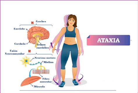 Ataxia En Ni Os Familia Y Salud