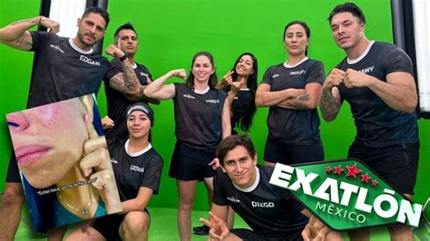 Exatl N M Xico Querida Atleta Roja Muestra Los Golpes Que Su Expareja