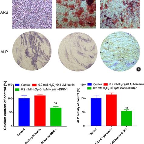 Inhibiting Wnt βcatenin signaling pathway with DKK1inhibited