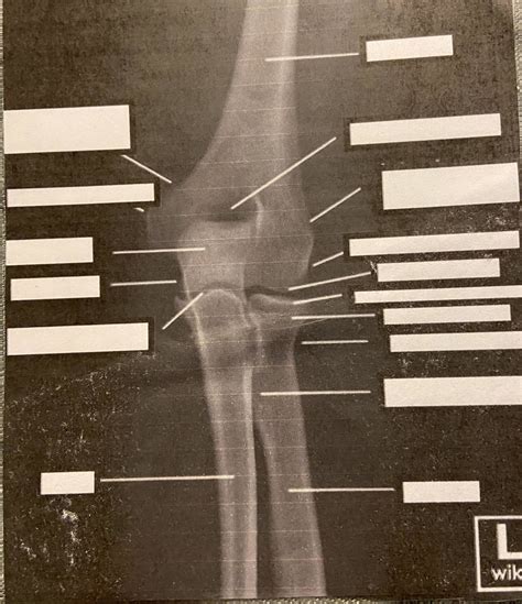 Elbow And Forearm Diagram Quizlet