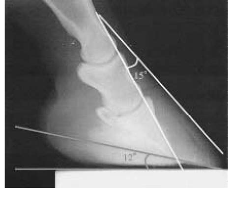 Displacement Of The Coffin Bone Same As Fig 2 White Line Indicates