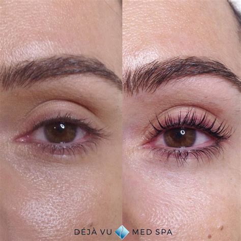 Lash Lift - Deja Vu Med Spa - Lash Lift Near Me Treatment