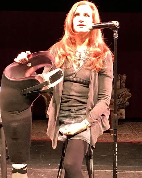 This Is What Losing A Leg Is Really Like Refinery29 Amputee Model Hot My XXX Hot Girl