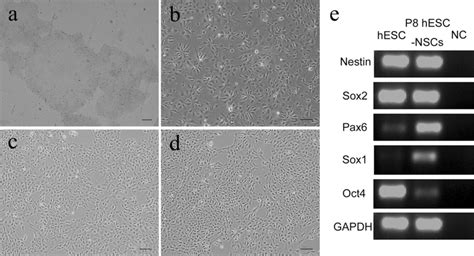 Human Embryonic Stem Cell And Hesc Derived Neural Stem Cells A Hescs