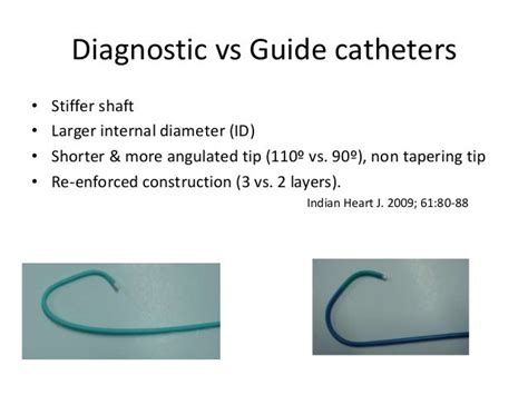 Guiding Catheter In Coronary Intervention