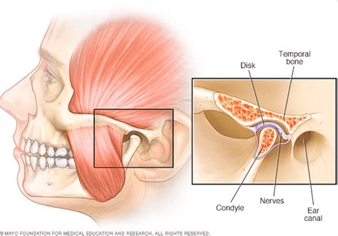 TMJ Disorders - Dr. Anthony J. Oliver