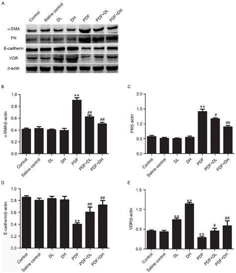 Effects Of 1 25 OH 2 D 3 On The Protein Expression Of Epithelial To