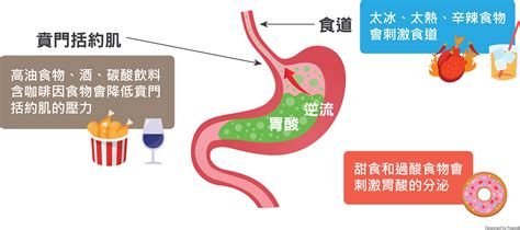 胃食道逆流飲食原則 李宜霖胃腸肝膽科