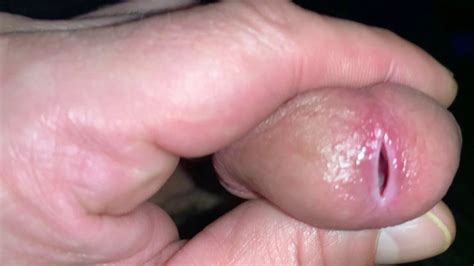 Peehole Stretch Progress Gay Man Man Porn Xhamster