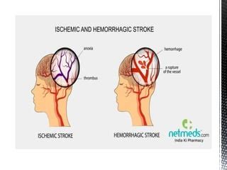 brain damage,causes, types,factors,etc.pptx