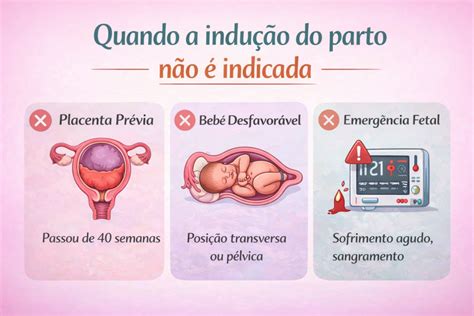 Como É Um Parto Induzido - Parto Induzido: Principais Motivos Que Levam o Médico a Induzir - Doula ...