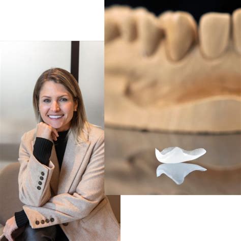 Microcarillas Dentales en Valencia Sofía Cortés Clínica Dental