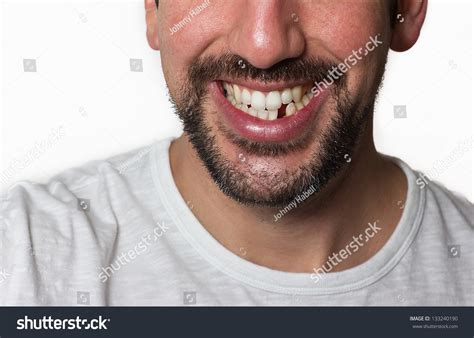 9,659 Teeth missing Images, Stock Photos & Vectors | Shutterstock