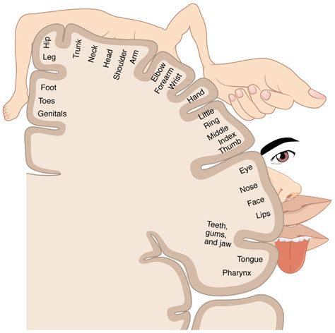 Homunculus Differential Diagnosis Of