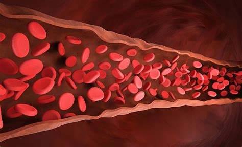 Prevention and management of venous thromboembolism - Med iLearning