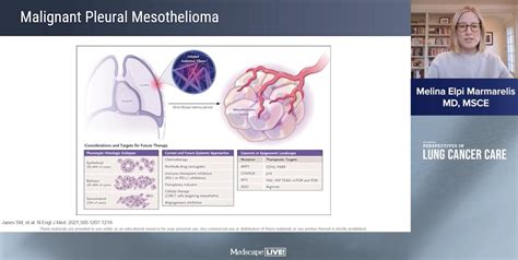 Stephen V Liu Md On Twitter Many Important Advances In Mesothelioma