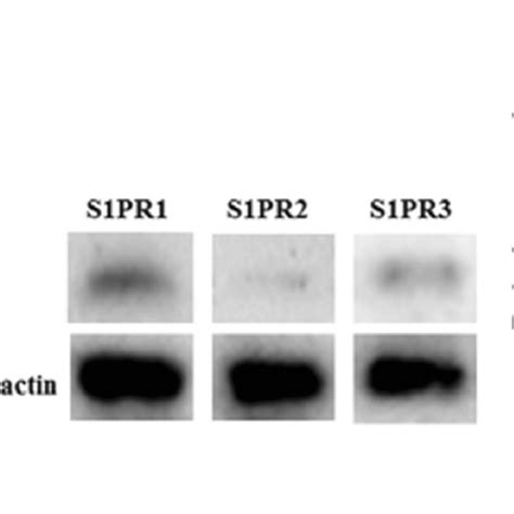 The Expression Of S1P Receptors In HUVECs Under Normal Conditions A