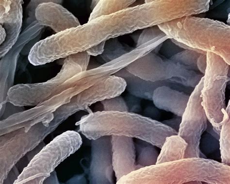 Cholera Bacteria Photograph By Ami Imagesscience Photo Library Pixels