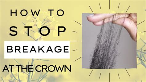 How To Stop Breakage In The Crown Grow 4C Hair Long YouTube