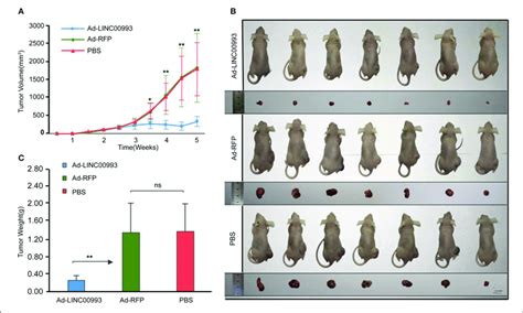 Linc00993 Suppresses The Growth Of Triple Negative Breast Cancer