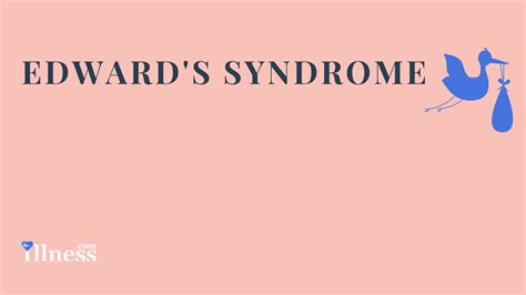 Edward S Syndrome Overview Causes Symptoms Treatment