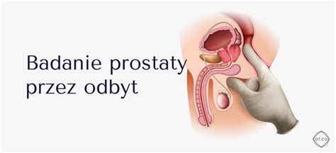 Czym Jest Prostata I Jak Zapobiega Jej Przerostowi Zdrowie