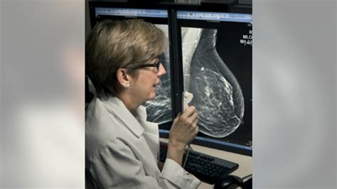 3d Mammograms Can Better Detect Invasive Cancers Reduce Call Back