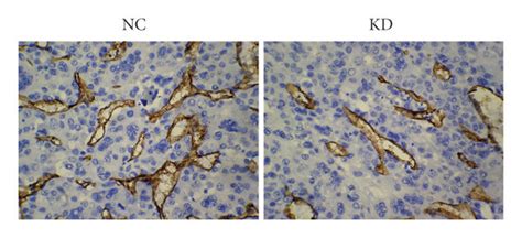 Comparison Of Smmc Cell Line Tumorigenicity And Induction Of