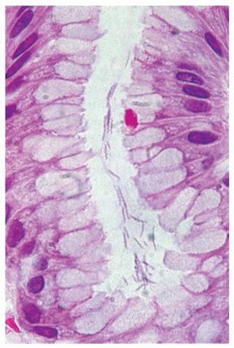 C13-FF73.gif | Abdominal Key 