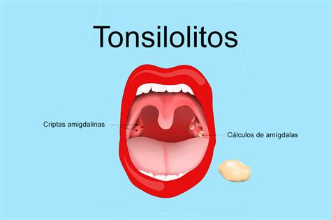 12 enfermedades de la boca más comunes Clínicas Den