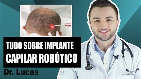 Tudo sobre Implante Capilar Robótico Dr Lucas Fustinoni YouTube