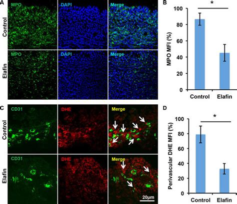 Elafin Administration Diminishes Neutrophil Infiltration And The